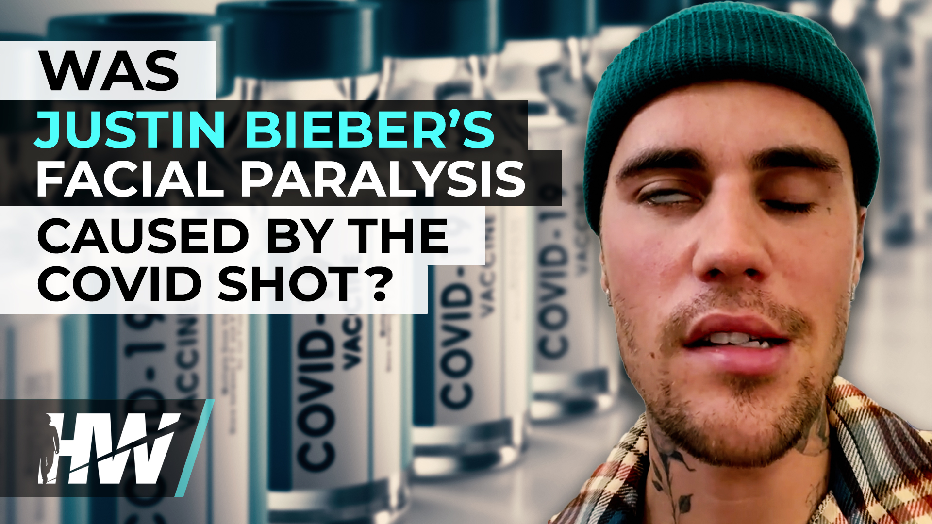 WAS JUSTIN BIEBER’S FACIAL PARALYSIS CAUSED BY THE COVID SHOT? - The ...