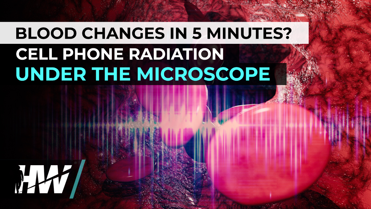 BLOOD CHANGES IN 5 MINUTES? CELL PHONE RADIATION UNDER THE MICROSCOPE ...